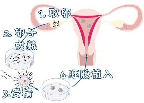 供卵代生医院生殖中心
